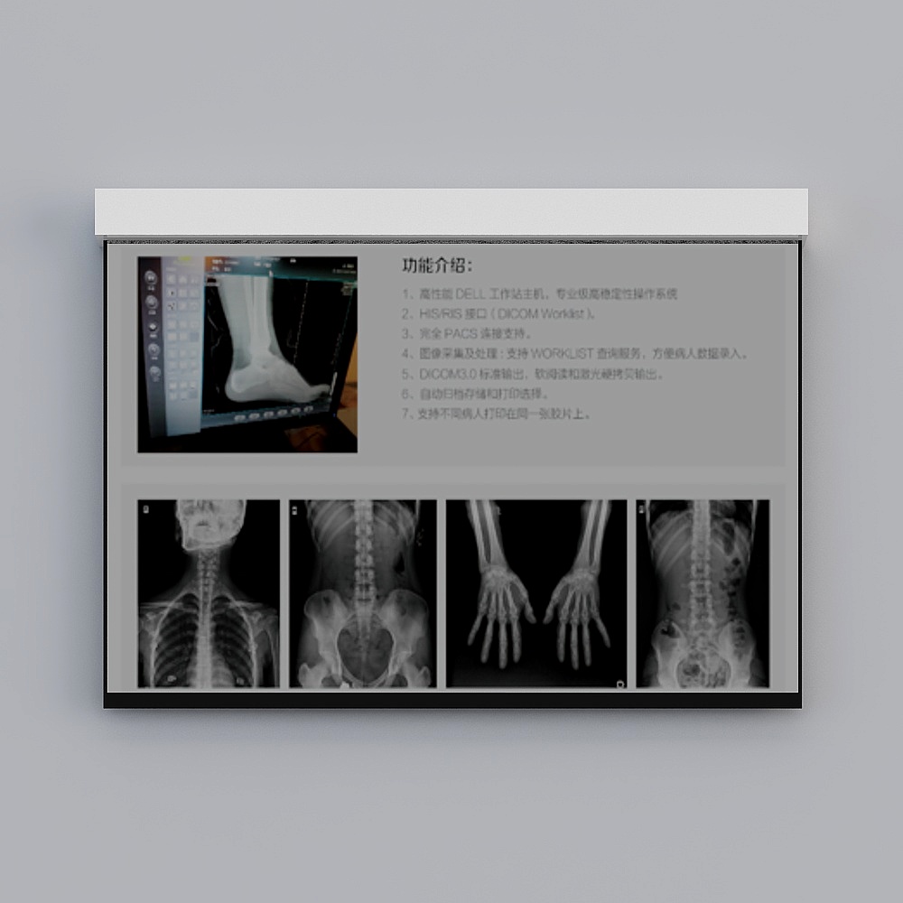 Orthopedic X-Ray 3D model for Medical Imaging