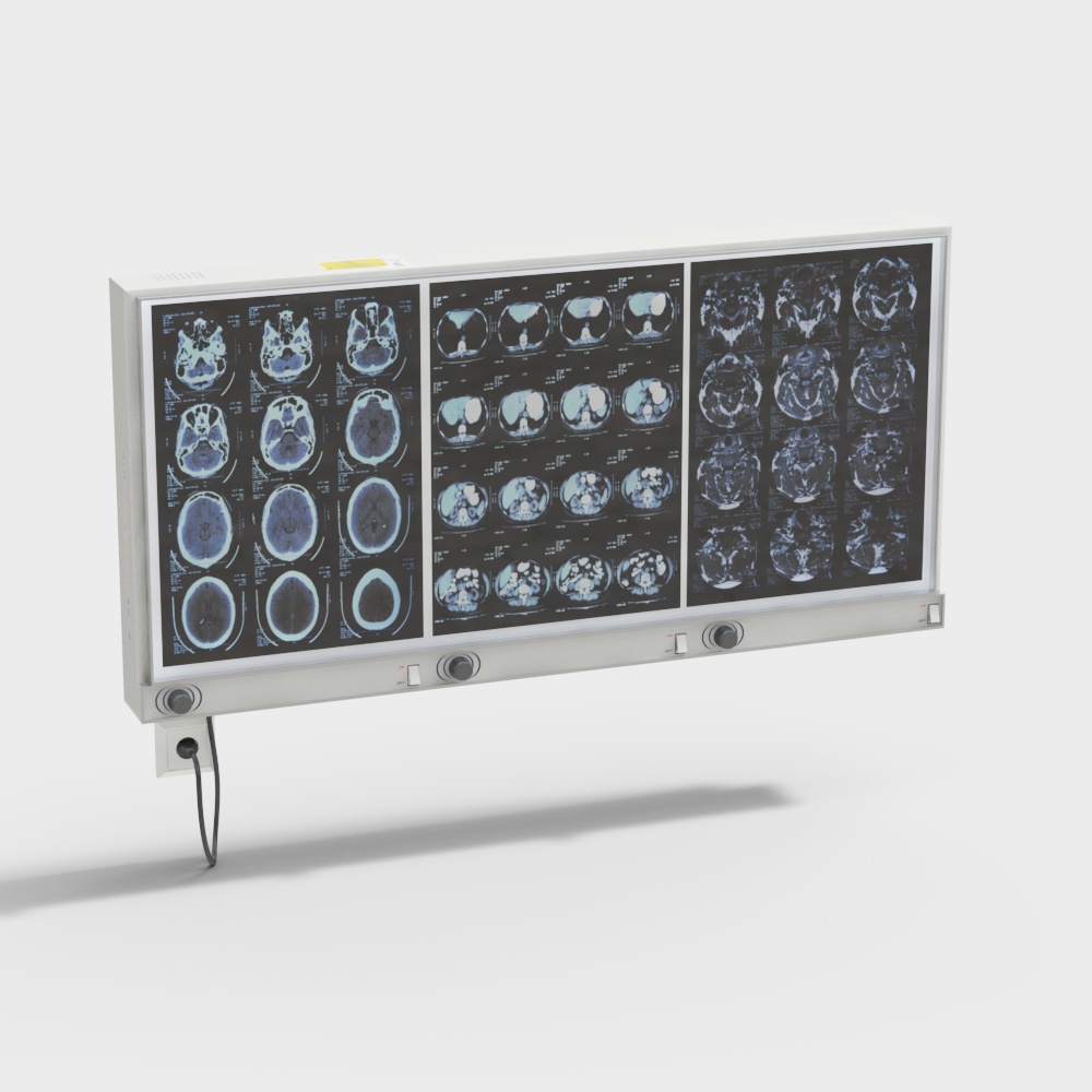 Highly Detailed 3D Model of Brain CT Scanner