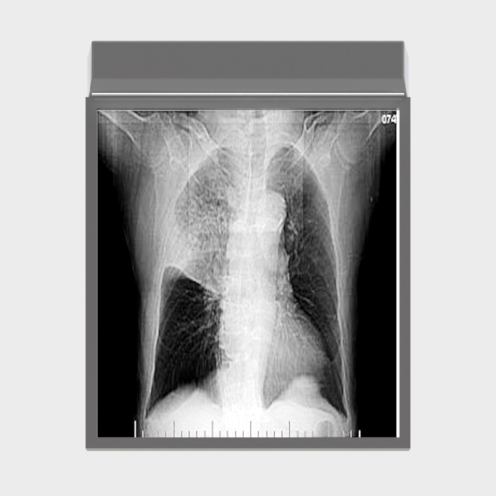 X-Ray Chest 3D model