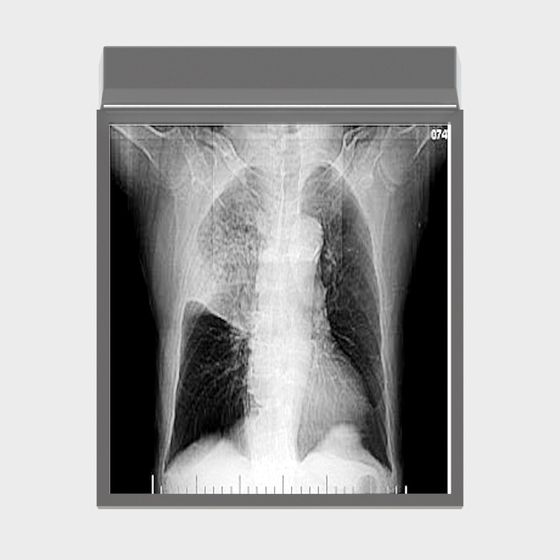 X-Ray Chest 3D model